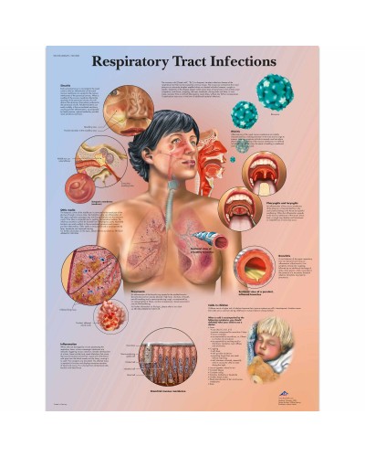 Диаграмма инфекций дыхательных путей